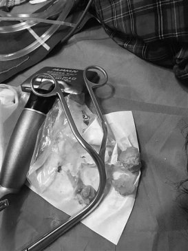 ͻȻ赹 ԭǱһö̵ƶס